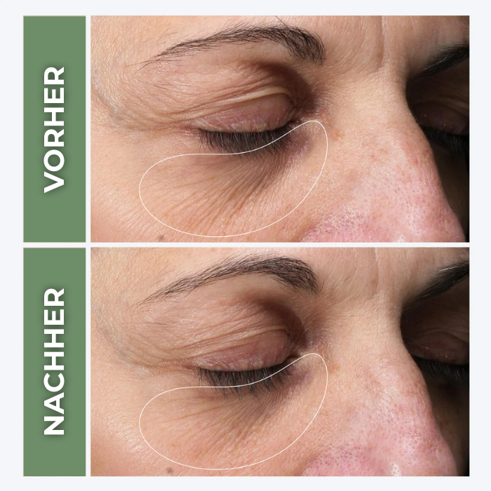 Novéa Eye Silk