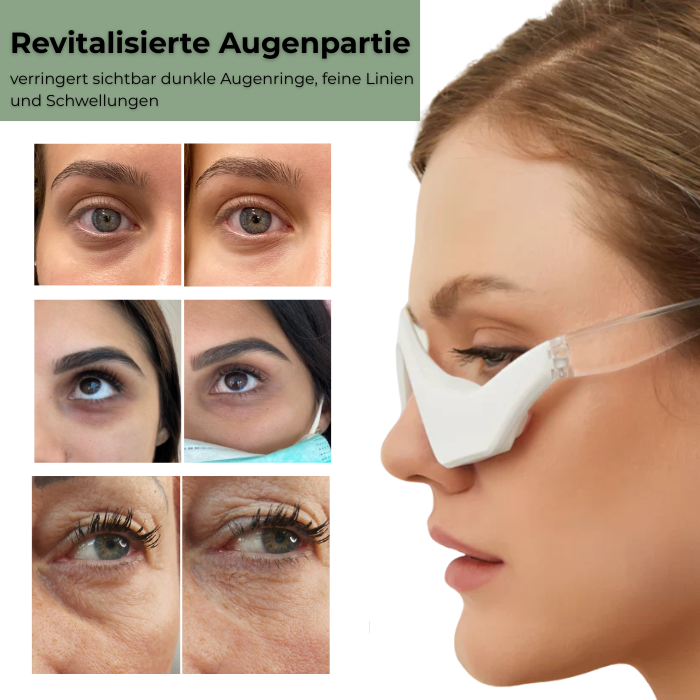 Luméa EyeLift™